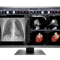 MONITOR EIZO RADIFORCE MX315W 31,5