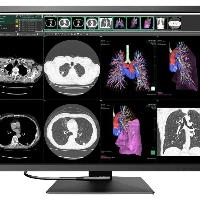 RadiForce Monitor 30.9 | Color 4200 X 2800 12MP