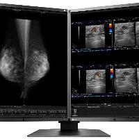 5 MEGAPIXEL MAMMO TOMO LTPS - 21,3  LED